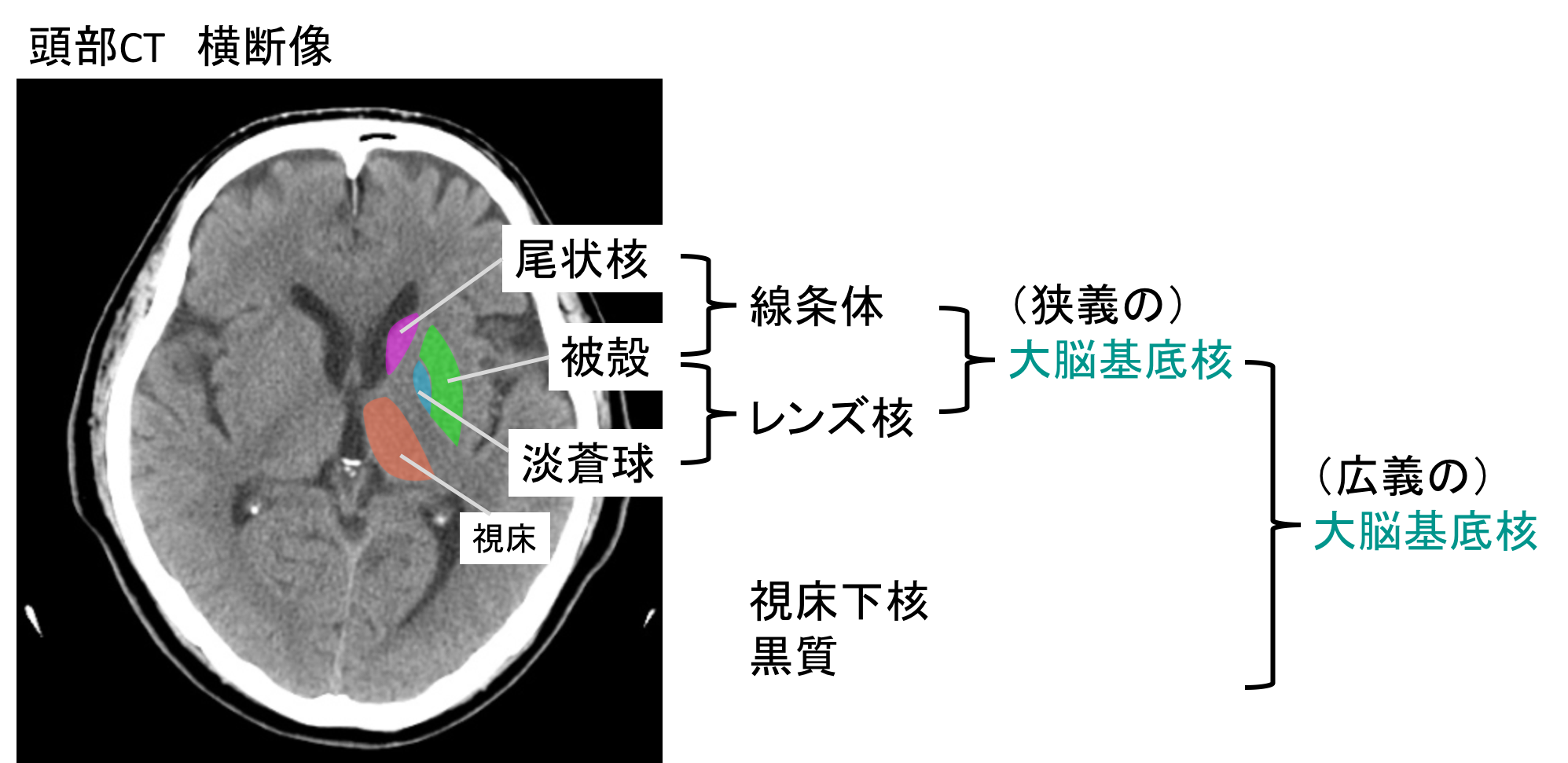 大脳基底核の定義と血管支配は？何動脈が栄養する？